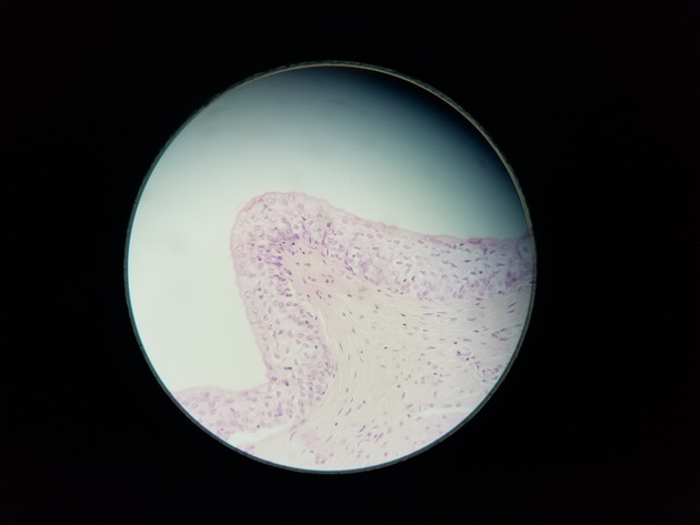 Transitional Epithelium Slides - Transitional Epithelium 06 400X